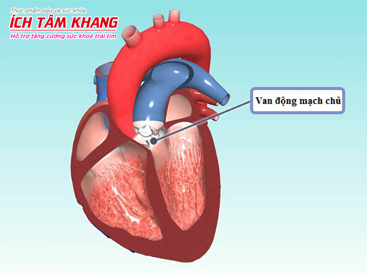 Nếu điều trị tốt, người bị hở van động mạch chủ sẽ không phải thay van tim